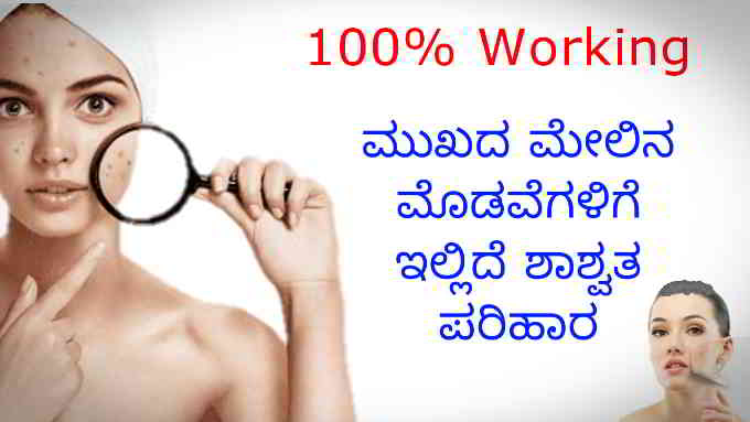 pemanent solutions for pimples in kannada