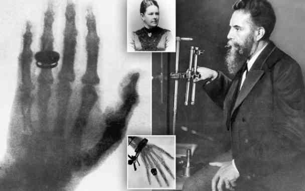 who invented the xrays and why in kannada